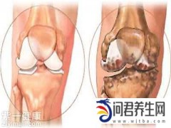 生活道公益健康:拍打膝关节可增进膝盖保护作用